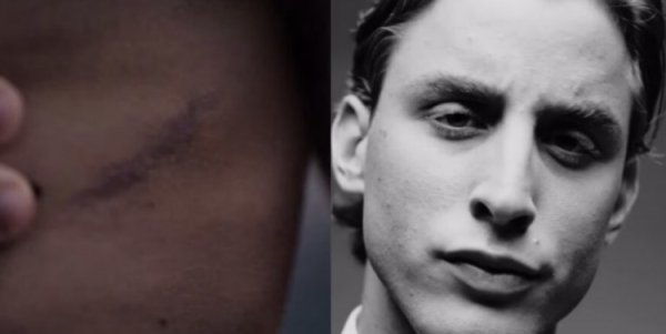 罗体：博维拍摄香水广告，首次展示了自己接受心脏手术后的伤疤