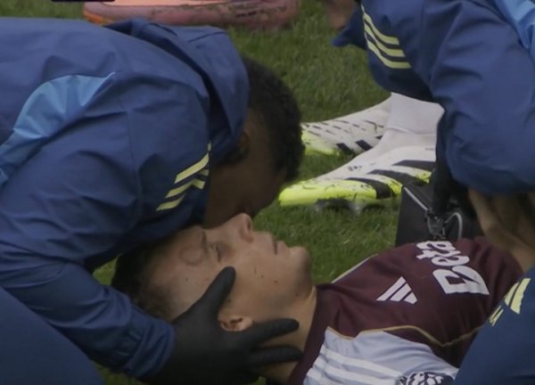 枭雄😨迪涅头上撞出一个明晰可见的大包，仍坚合手比赛