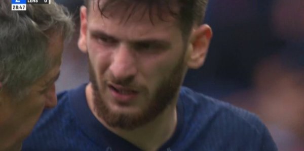 看着就疼！K77遭爱德华铲球受伤伤退，小腿两道血痕十分明显